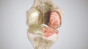 Image credit: crevis | stock.adobe.com