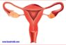 Buy pregnyl 1500 online – ideal for you